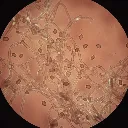 Ganoderma IA ejemplo.webp